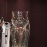 Врач-косметолог у аппарата Endospheres и объёмная модель лимфатической системы таза